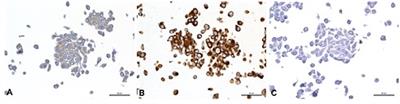 Evaluation of in vitro intrinsic radiosensitivity and characterization of five canine high-grade glioma cell lines